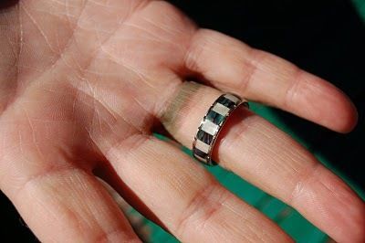 prevenir-cerco-verde-dedo-bisuteria-anillos prevenir-cerco-verde-dedo-bisuteria-anillos
